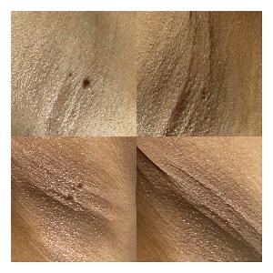 韓國碳化無疼脫尤/油脂粒 (全面任脫 - 體積2mm直徑或以內)/每粒