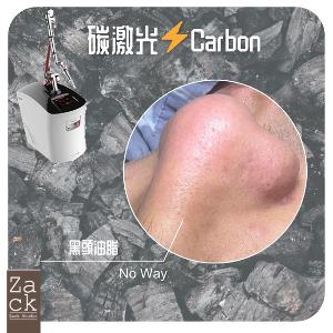 Carbon Laser 碳激光淨化療程-體驗價