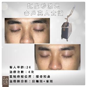 PICO Laser 面部嫩膚療程-體驗價