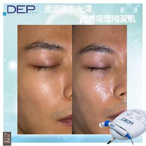 D.E.P 無針肌底水光療程-體驗價